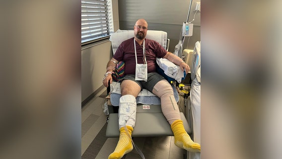 Huntsville police sergeant recovering after being shot in the line of duty