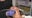 5 procedures to reduce the signs of turkey neck