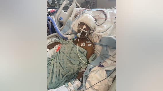 Missing Houston man found injured in apartment stairwell: Family claims foul play