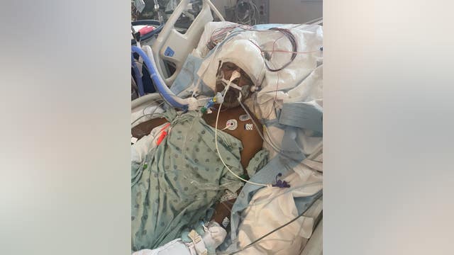 Missing Houston man found injured in apartment stairwell: Family claims foul play