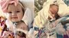 4-month-old's mother shares emotional journey of daughter in need of life-saving lung transplant