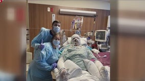 Houston man survives having 90% of his body burned