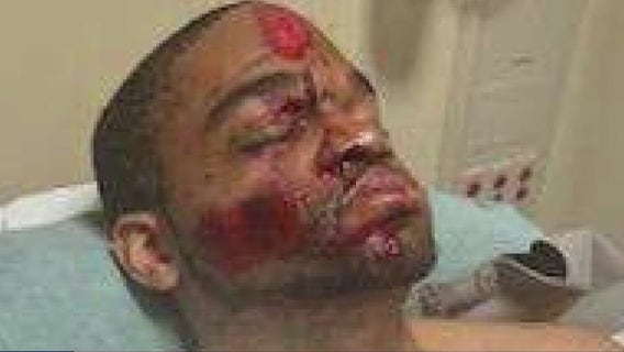 Katy autistic man ran over, sheriff's deputies searching for elderly man