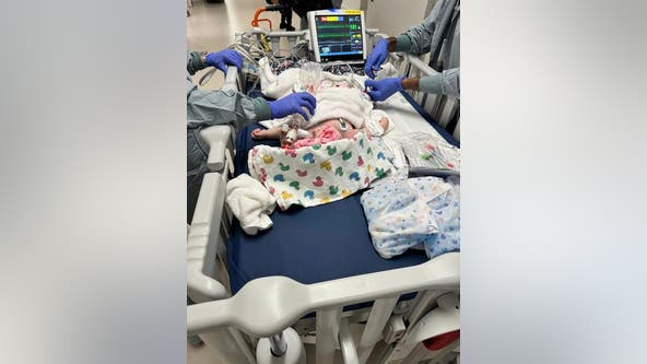 UPDATE: Donor found for 5-month-old with rare lung disease at Texas Children's, awaits transplant
