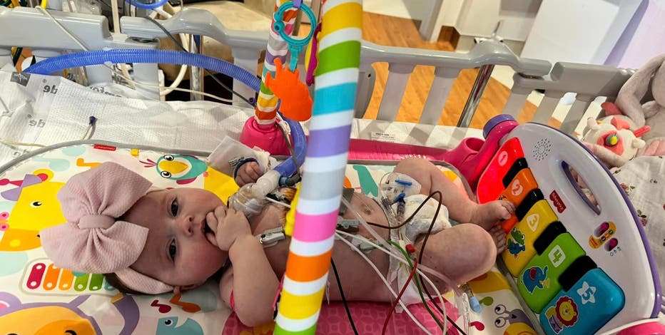 Infant's double-lung transplant successful at Texas Children's Hospital