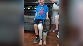 Texas grandmother asks for help locating grandson's missing prosthetic leg