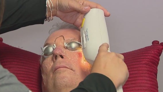 Zapping away dry eyes with intense light