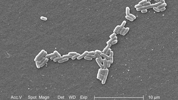 The Woodlands Triathlon cancels swim portion due to high bacteria in lake