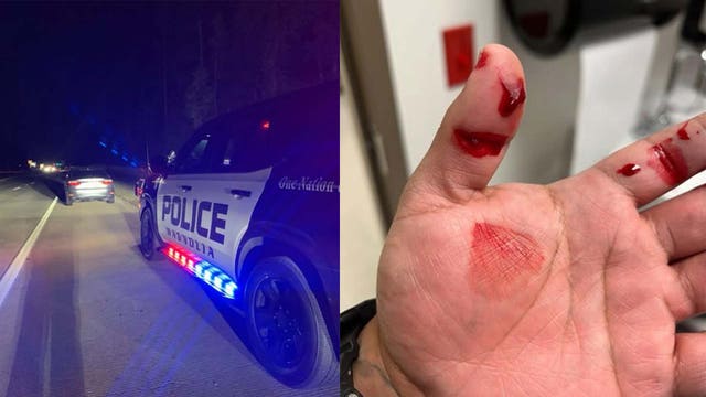 Magnolia police officer bitten by DWI suspect who peed in patrol vehicle