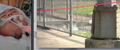 14-year-old boy hospitalized after being shocked by light pole at SE Houston park