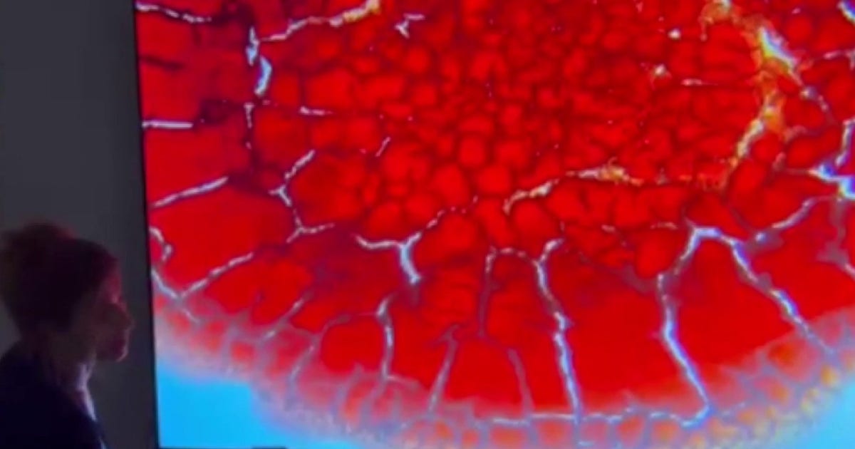 Cyclospora & other parasites: What you need to know about risks, treatment