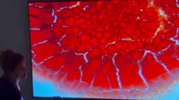Cyclospora & other parasites: What you need to know about risks, treatment