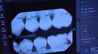 How AI in dentistry is transforming smiles