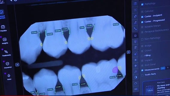 How AI in dentistry is transforming smiles
