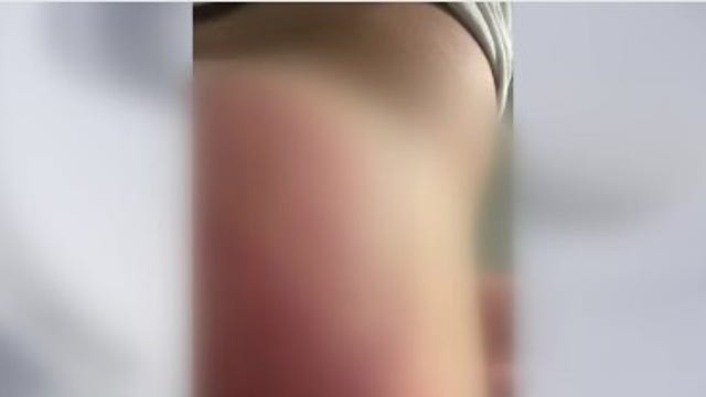 15-year-old speaks out after coach paddled him at Port Arthur ISD