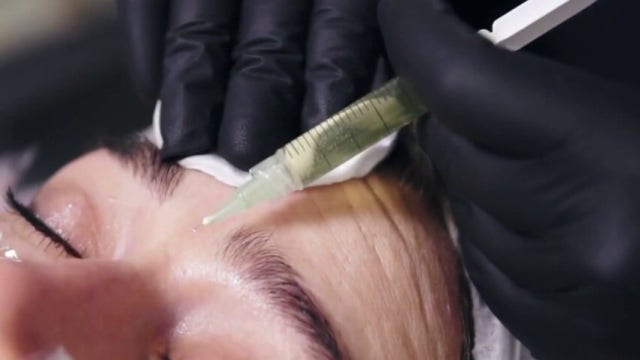 What is 'zombie filler'? Doctors use donor fat to restore volume