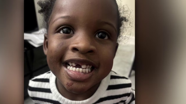 Mother wants answers from daycare about 3-year-old's missing tooth