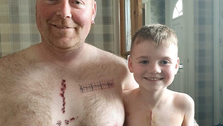 A father gets a tattoo of a surgical scar to match son's life-saving surgery scar.