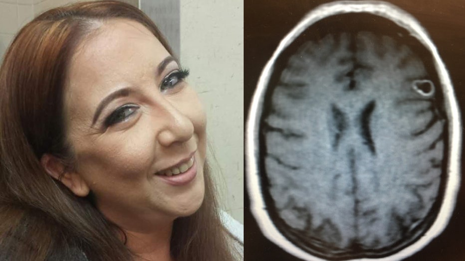 Rachel Palma, pictured, went to the doctor after experiencing some unusual symptoms and discovered she had a brain lesion. It turned out to a tapeworm egg.