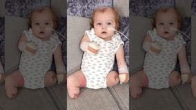 UK baby loses all 4 limbs following sepsis infection, mom claims one leg 'came off in her hand'