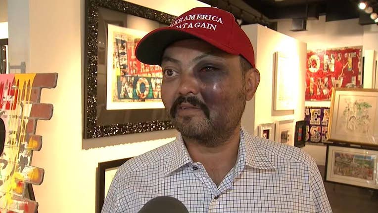 Man says he was beaten in NYC for wearing MAGA hat