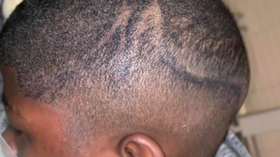 School administrators sued for using permanent marker on boy's head.