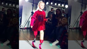 Double amputee, 9, to walk New York Fashion Week runway: 'Disability doesn’t stop you'