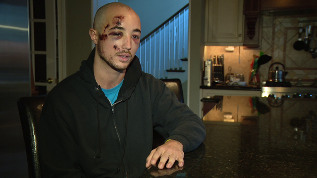 Police: Temple student struck by hit-and-run driver in Sea Isle City