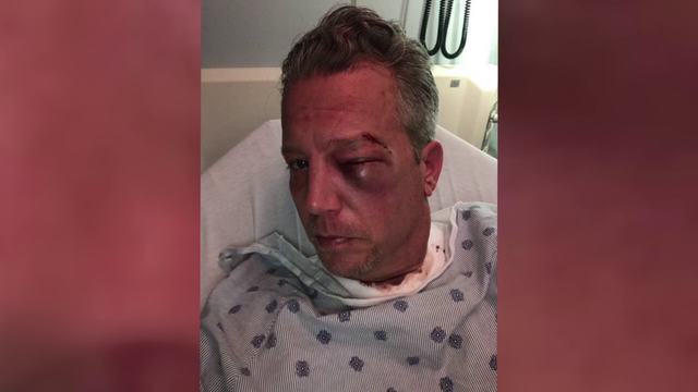 Bellmawr police officer accused of throwing sucker punch at wedding