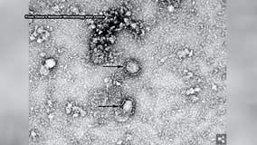 Health officials investigating possible coronavirus case in Philadelphia