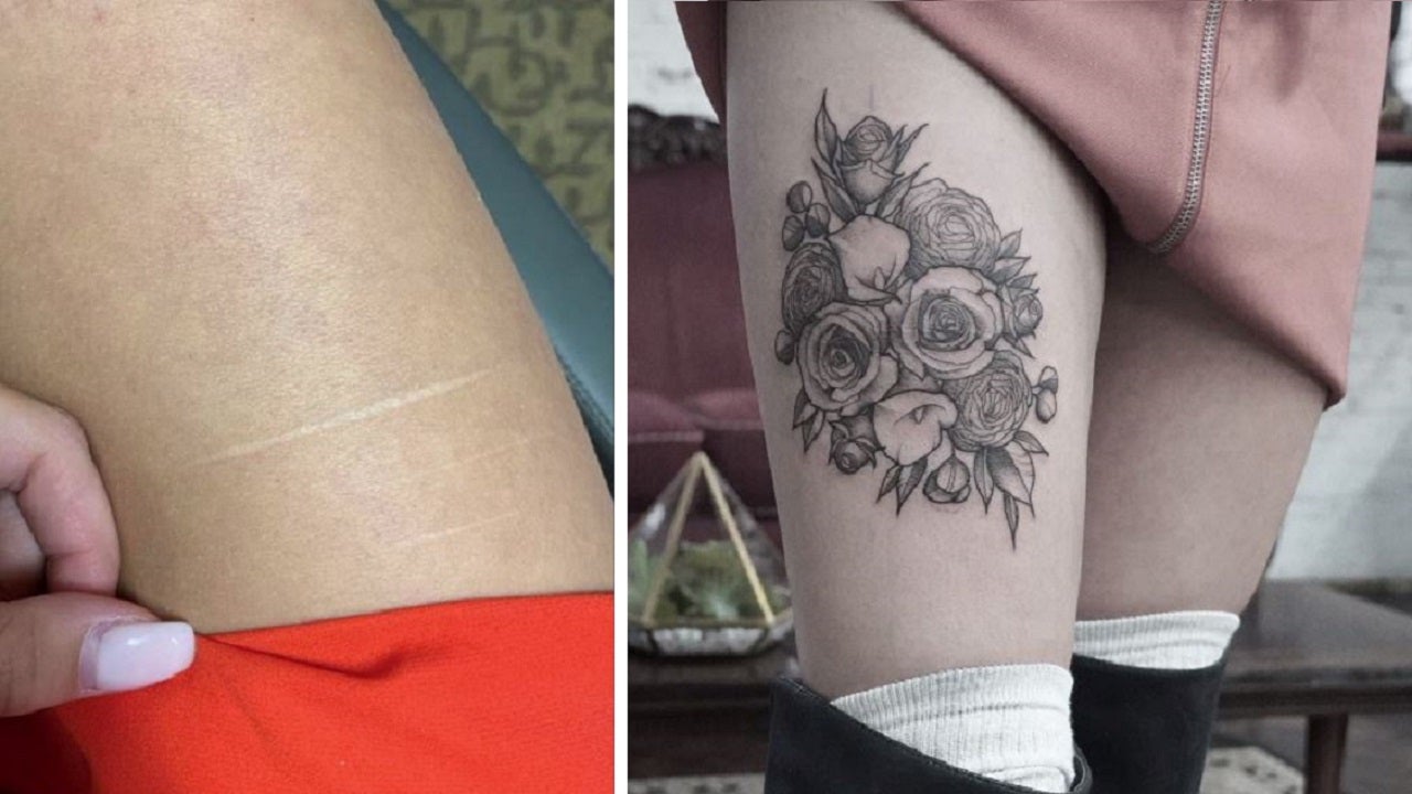 Self scars over tattoo harm 3 Men