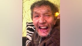 Police searching for missing 65-year-old man from North Philadelphia