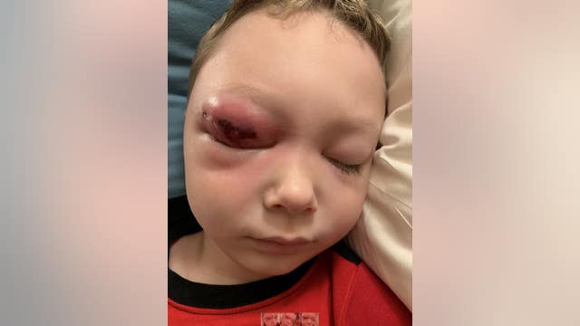 Central Florida family struggling to get back to U.S. with sick child on cruise