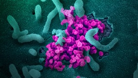 Pennsylvania announces 75,592 cases of COVID-19; 5,943 deaths