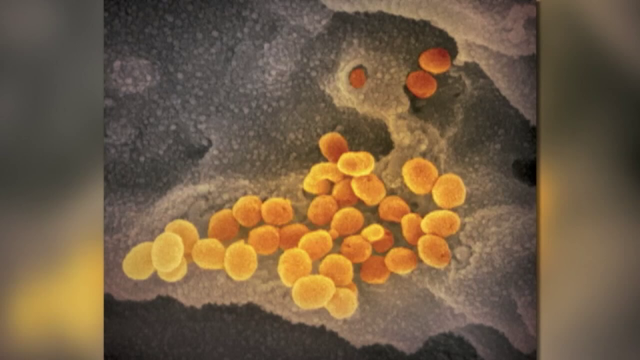 2 new presumptive positive coronavirus cases in Montgomery County bring Pa. total to 6