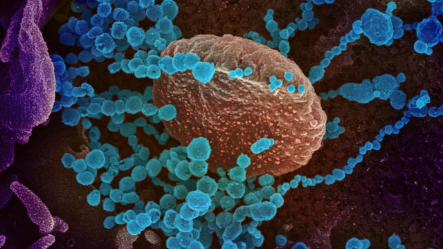 1st COVID-19 coronavirus death in New Jersey was veteran horseman