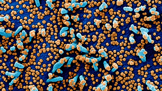 First coronavirus-related deaths reported in Delaware County