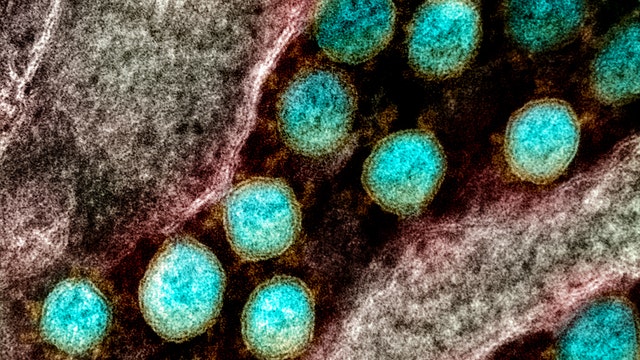 Northeast Philadelphia ShopRite employee tests positive for coronavirus