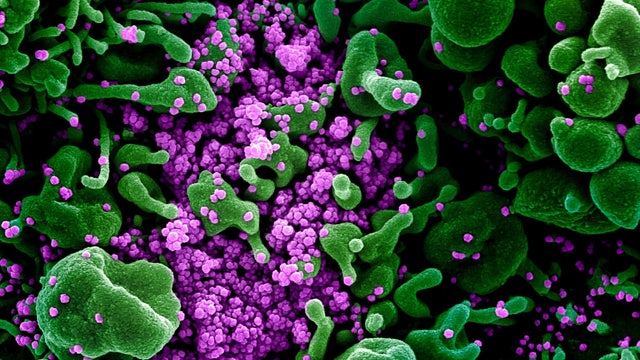 What you need to know today about the coronavirus pandemic