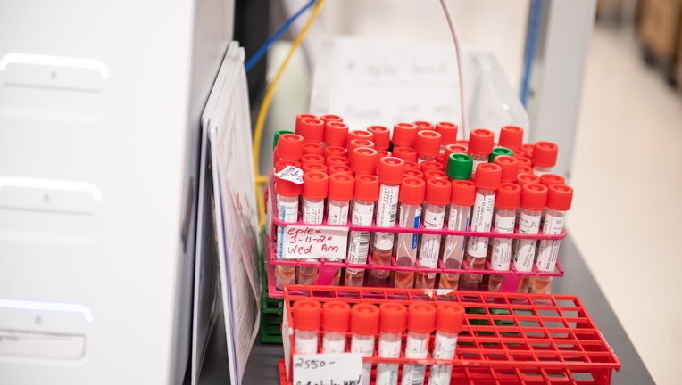 Long Island Laboratory To Start Semi-Automated Coronavirus Testing