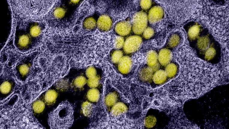 COVID-19 coronavirus
