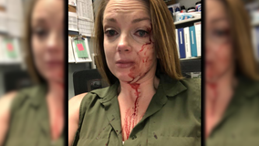 California retail employee posts photo of her bloody face after alleged customer attack