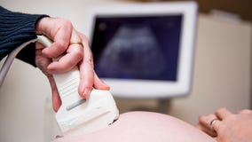 Preliminary study finds injury to placenta in pregnant women with COVID-19