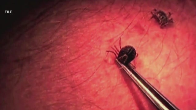 Some symptoms of Lyme disease are similar to COVID-19, health officials say