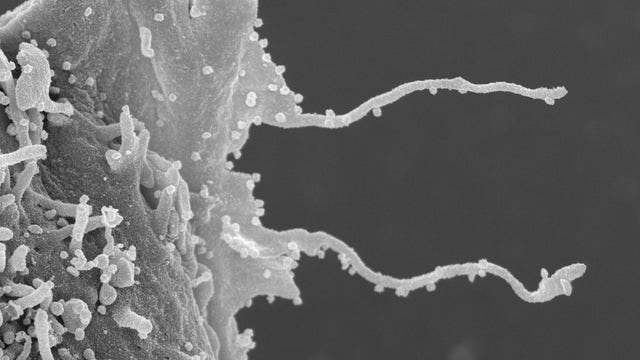 COVID-19 infection triggers growth of arm-like tentacles in cells, microscope images show