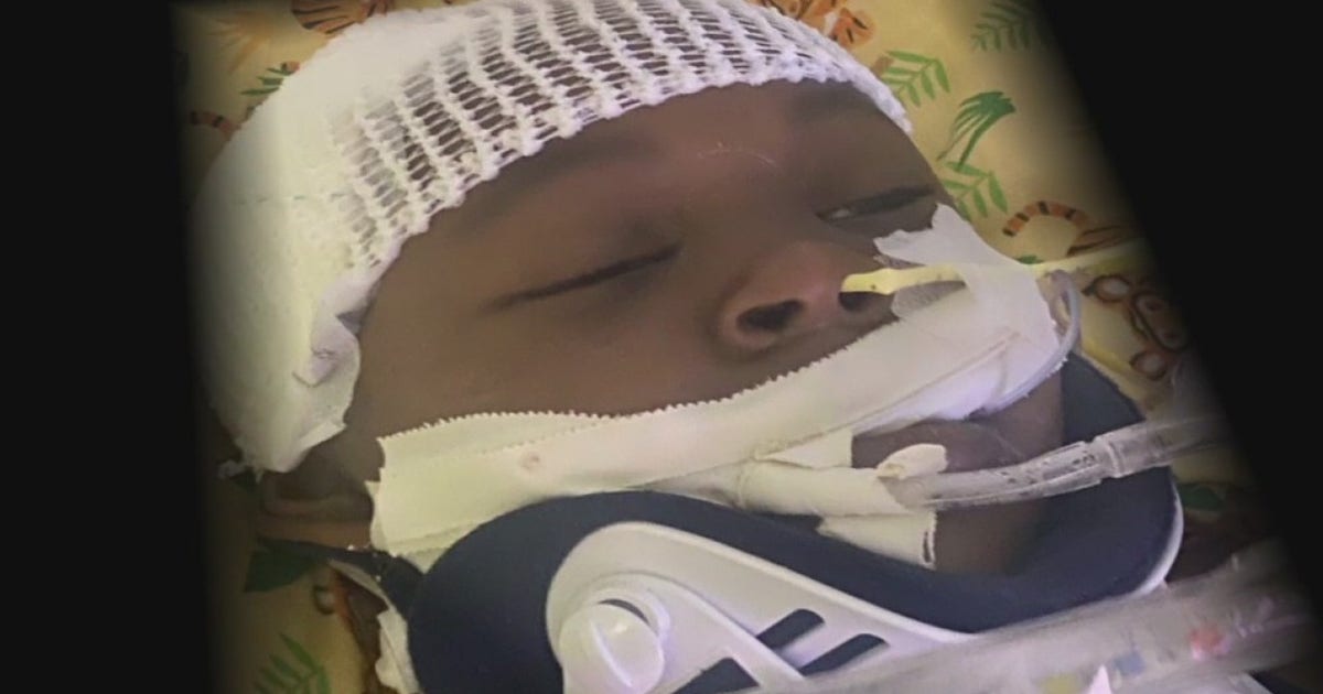 Family of 4-year-old hospitalized after being hit by car in desperate ...