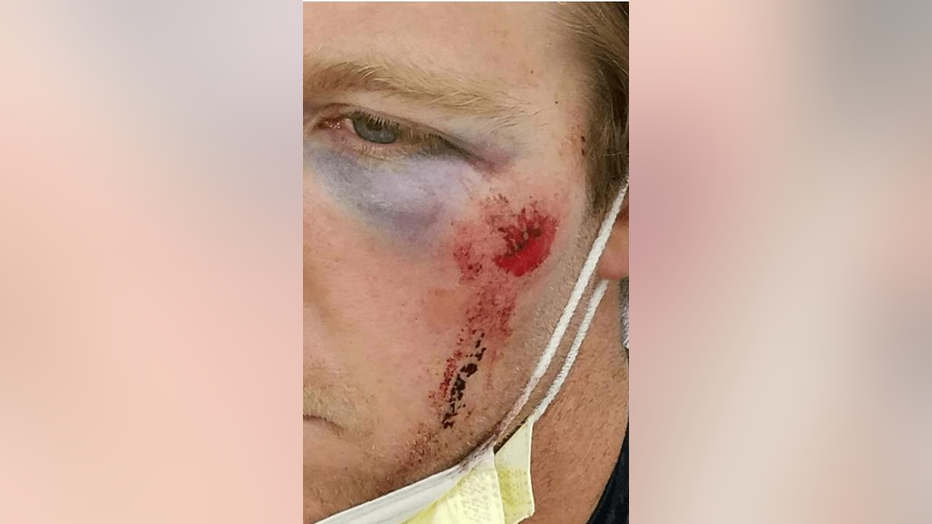 Officer-hurt-1.png