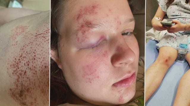 Mother pleads for hit-and-run driver to turn themselves in