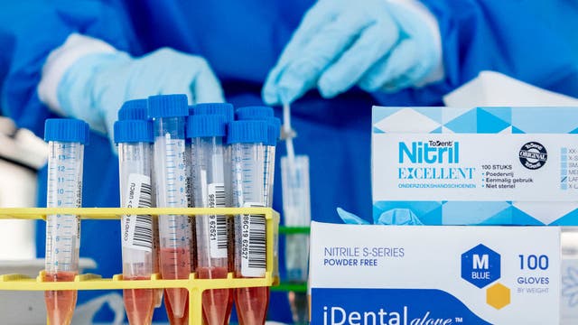 NIH STUDY: Researchers find evidence to suggest COVID-19 can cause brain damage