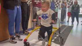 Toddler, paralyzed from neurological disorder, given celebratory sendoff as he walks out of hospital